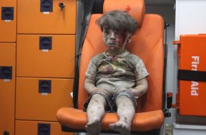 The image of Omran Daqneesh, 5, bloodied and covered with dust, is another stark reminder of the toll of the war in Syria.